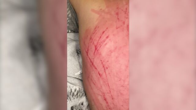 Back scratch Part 2 long natural nails