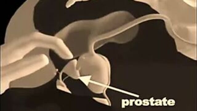 Prostate Massage Techniques